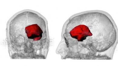 صورة تطوير وسيلة علاجية جديدة للقضاء على أورام المخ