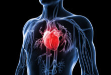 صورة منظومة جديدة للذكاء الاصطناعي لتشخيص نوبات القلب